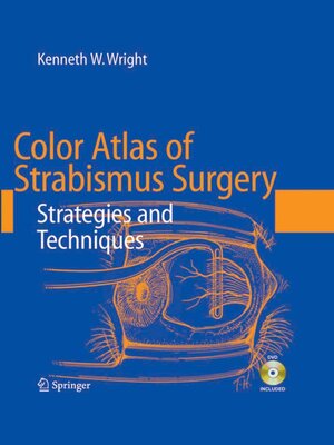 cover image of Color Atlas of Strabismus Surgery